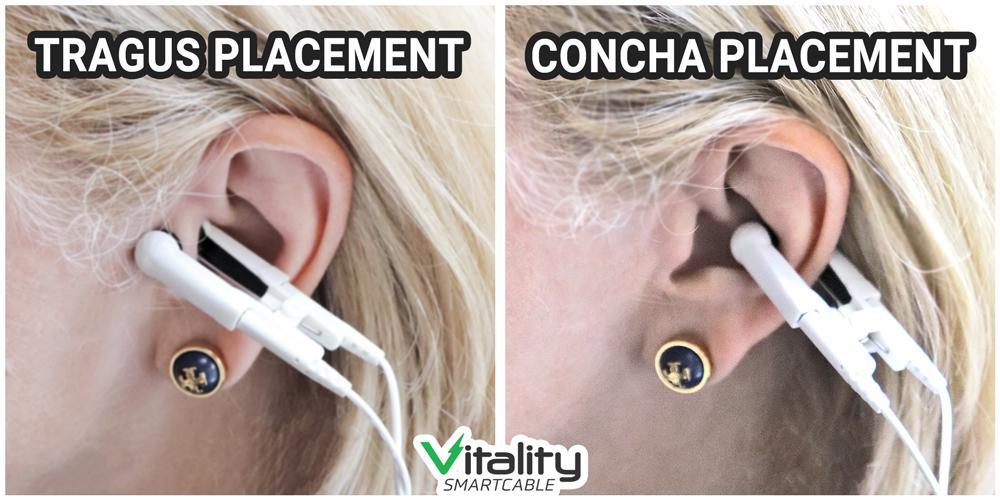 Vitality Smartcable® GENTLE Replacement Ear Clips (Set of 2)